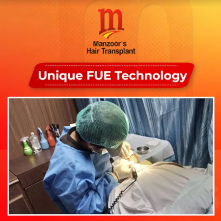 Follicular Unit Extraction – (FUE)